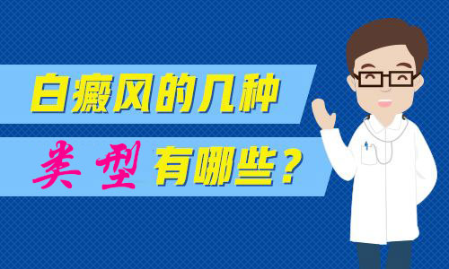 皮膚患白癜風疾病有哪幾種類型