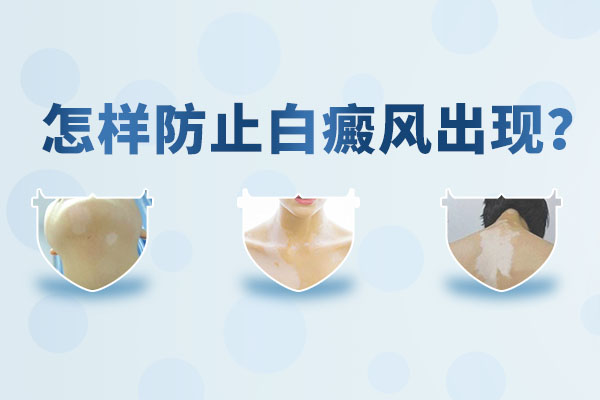 如何預(yù)防白癜風(fēng)比較科學(xué)呢？