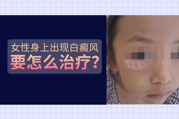 女孩子臉上長(zhǎng)塊白癜風(fēng)要怎么處理呢？