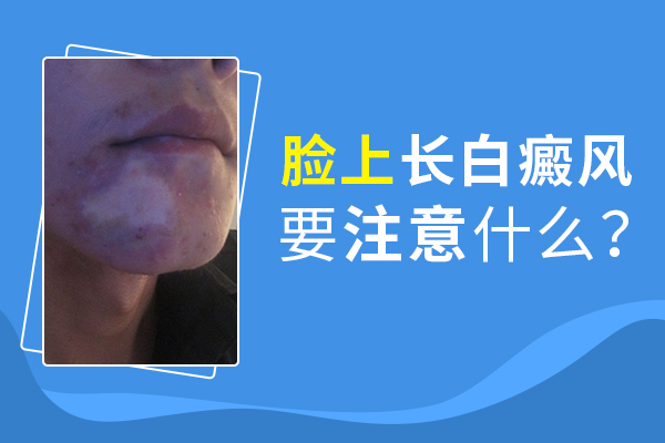 臉部白癜風(fēng)患者應(yīng)該怎么護(hù)理呢？