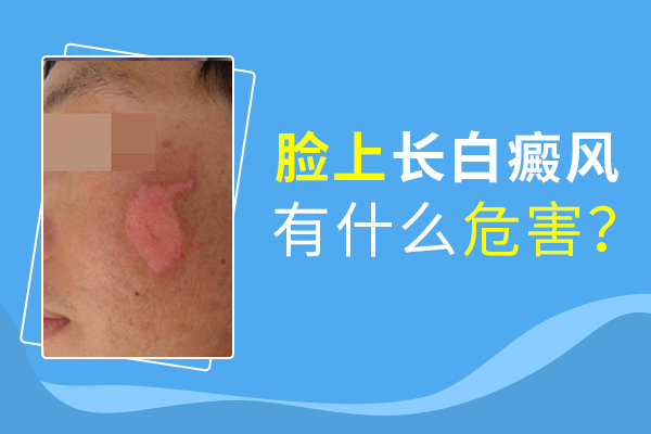 臉部白癜風(fēng)會(huì)給患者帶來(lái)什么傷害呢？