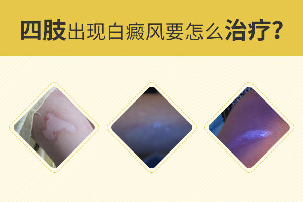 為什么手腳上的白癜風(fēng)會(huì)比較難治呢？